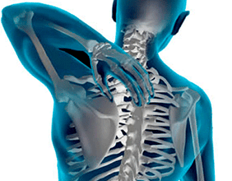 Manifestations of Osteocondrosis of the Torakal Belt